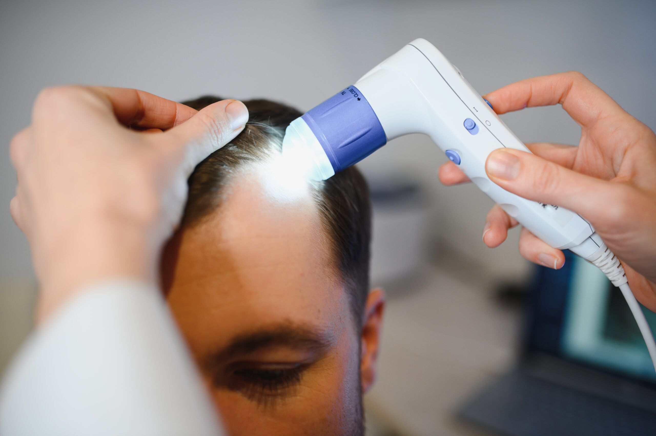 Dermatologist examining patient for low-level laser hair therapy