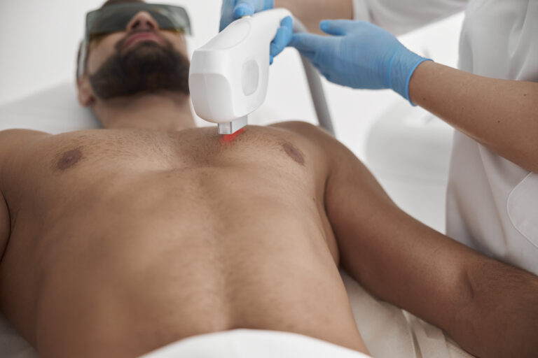 Man receiving laser hair removal on arms and chest