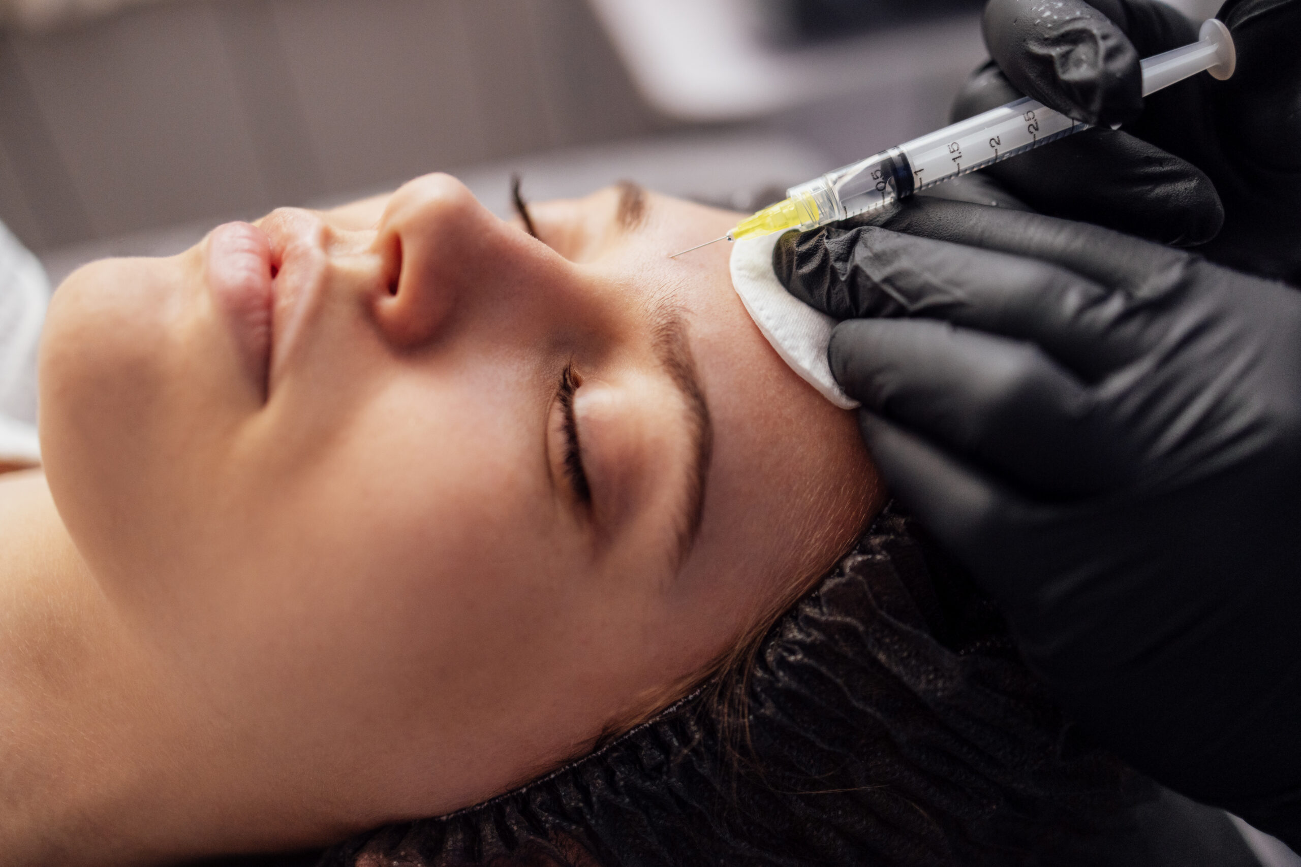 PRP facial injection for skin rejuvenation