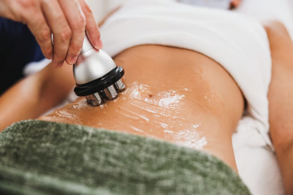 Candela VelaShape III body contouring