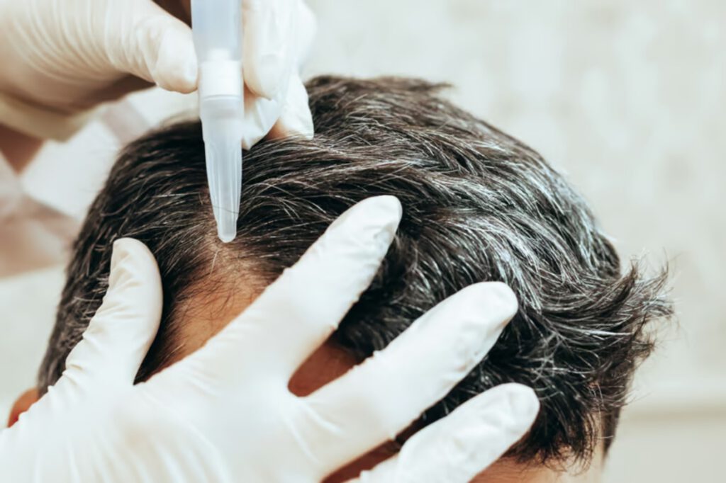 HydraFacial Keravive scalp treatment