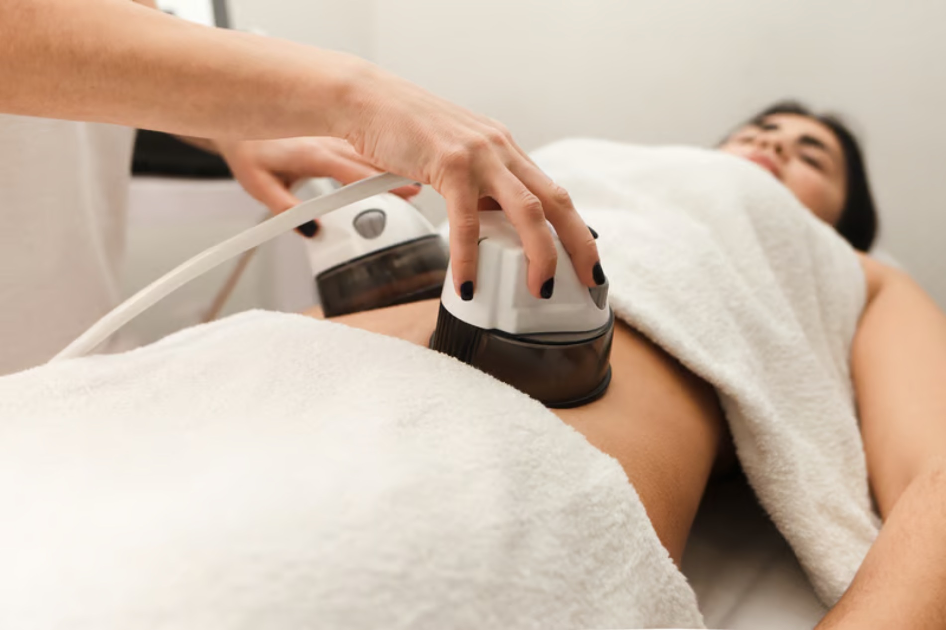 RF skin tightening treatment